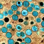 A colorized transmission electron micrograph of monkeypox virus particles (teal) found within an infected cell (brown)