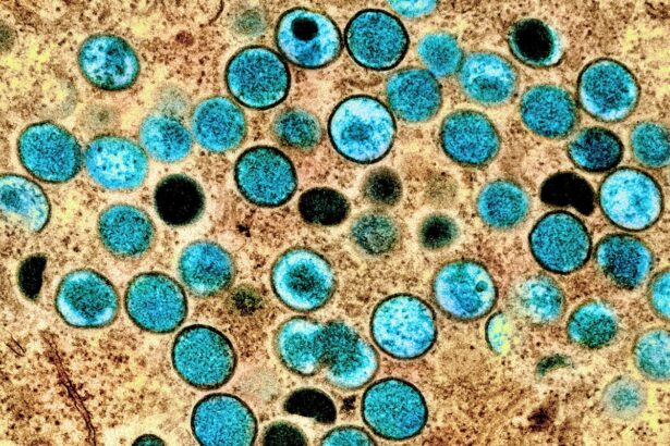 A colorized transmission electron micrograph of monkeypox virus particles (teal) found within an infected cell (brown)