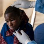 Mpox: How deadly is the virus and what treatments are available?