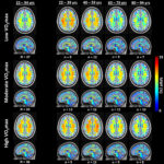 Study links cardiovascular fitness to brain health