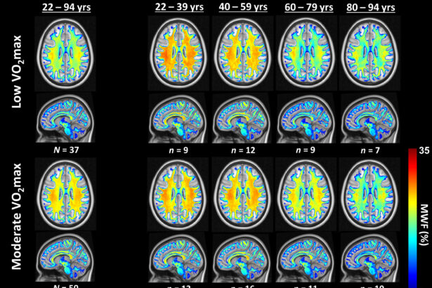 Study links cardiovascular fitness to brain health