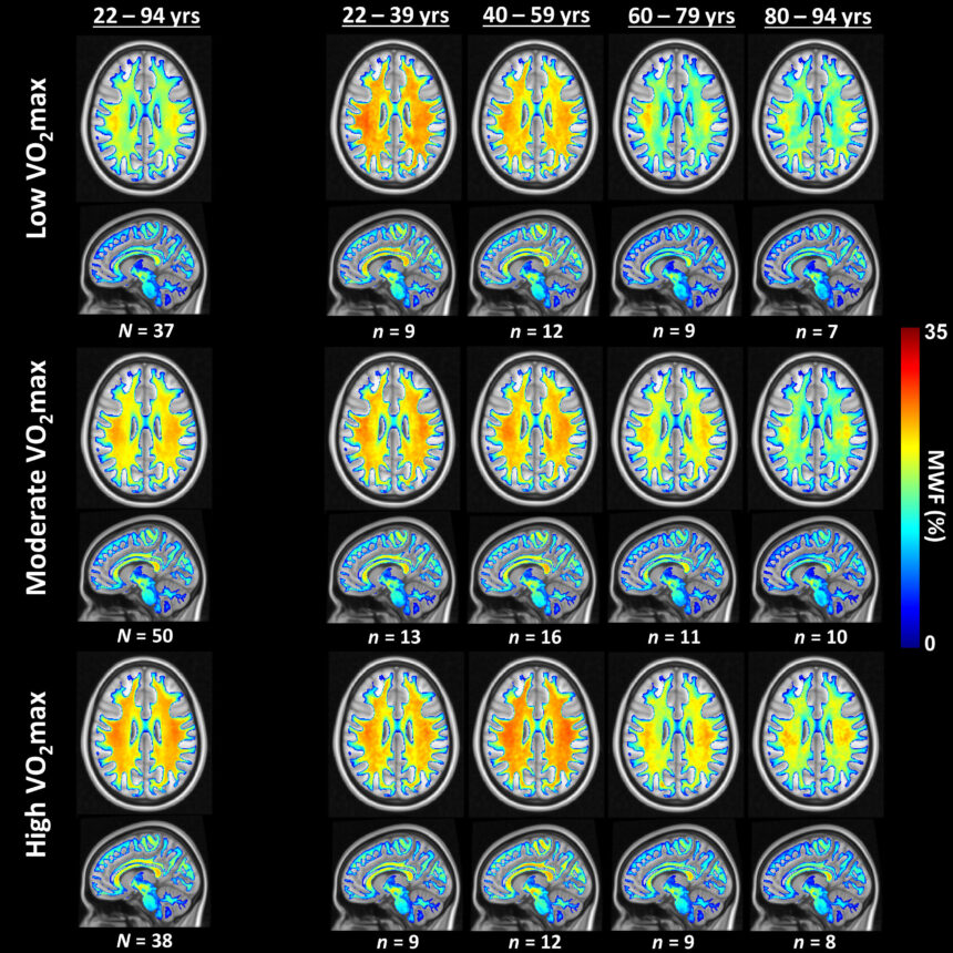 Study links cardiovascular fitness to brain health