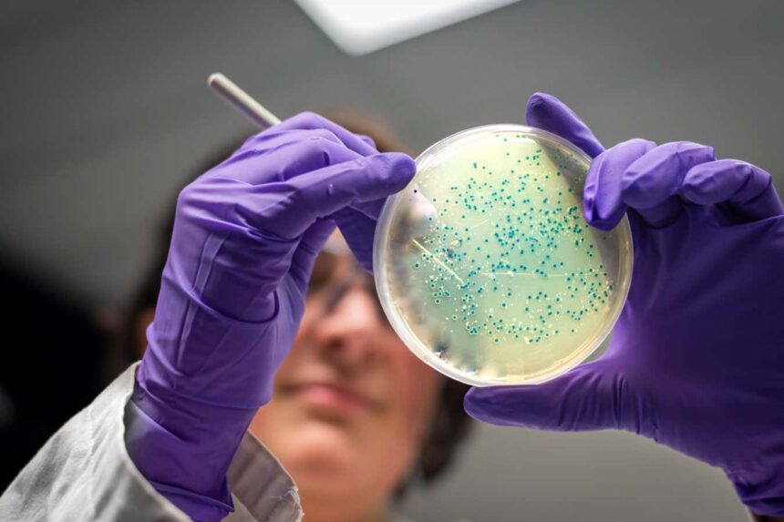 Antibiotic resistance forecast to kill 39 million people by 2050