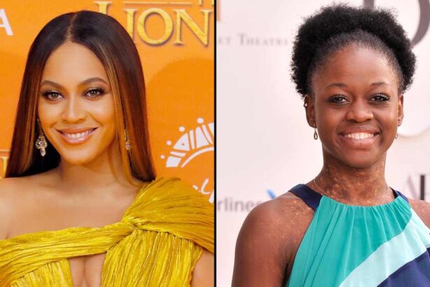 Beyonce Once Called Michaela DePrince a ‘Creature From Another Planet’