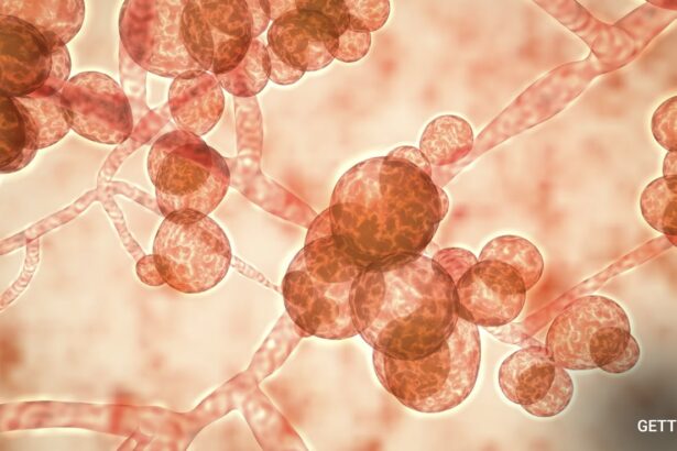 Deadly Fungal Infections Are Evolving And Causing “Silent Pandemic”, Scientists Warn
