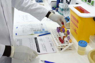 It’s past time to end HIV wonder drug experimentation in Africa