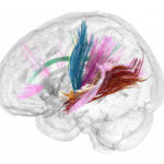 A clear model of a human brain shows colorful thin lines moving from one part of the brain to another.