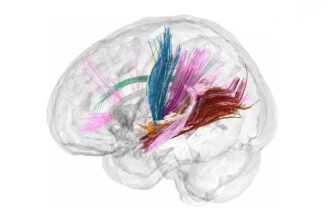 A clear model of a human brain shows colorful thin lines moving from one part of the brain to another.