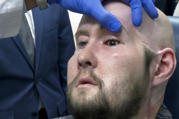 A man who received an eye and partial face transplant is examined by a doctor