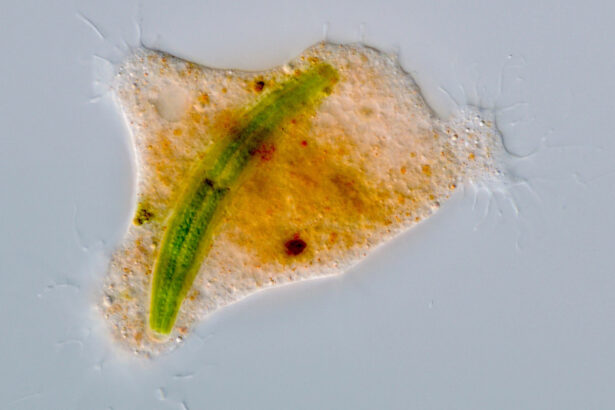 This amoeba eats prey like owls do