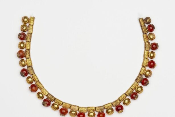 Boston Museum Returns Looted 2,700-Year-Old Necklace to Turkey