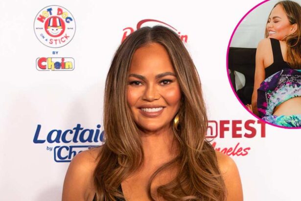 Chrissy Teigen Laughs Off White Castle Semi-Permanent ‘Tramp Stamp’