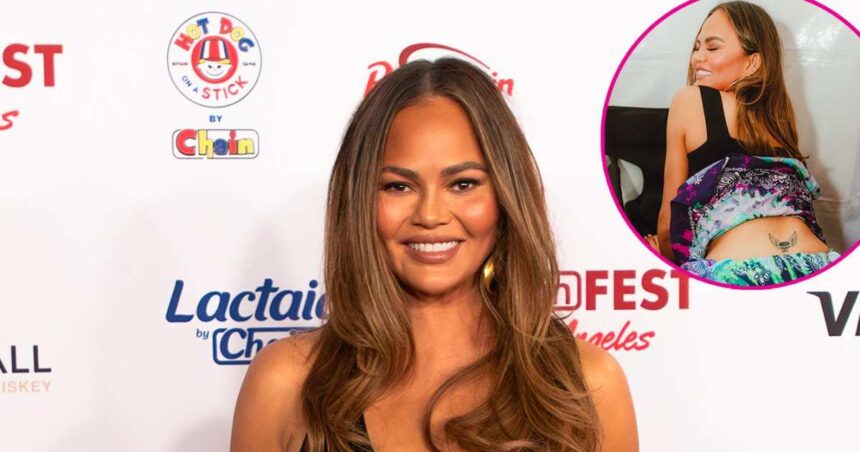 Chrissy Teigen Laughs Off White Castle Semi-Permanent ‘Tramp Stamp’