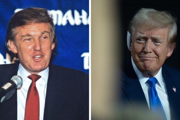 Donald Trump’s Transformation: Before & After Photos
