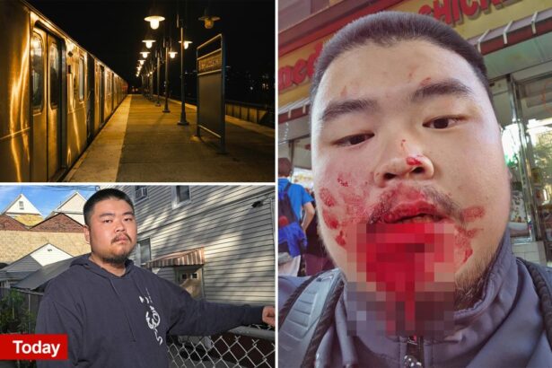 ‘Felt like it was a knife’