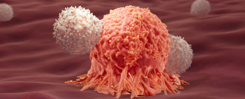 Immune Response Thought to Aid Cancer Could Be an Unexpected Cure : ScienceAlert