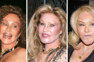 Jocelyn Wildenstein's Transformation Gallery: Before & After Photos