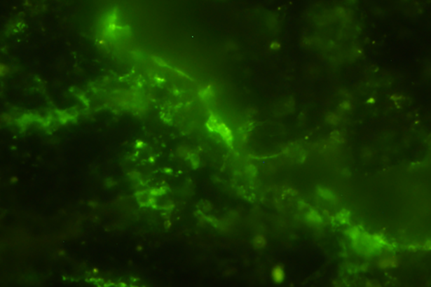 Oldest living microbes found in 2-billion-year-old rock