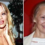 Pamela Anderson, 57, Going 'Cold Turkey' on Botox and Fillers