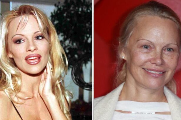 Pamela Anderson, 57, Going ‘Cold Turkey’ on Botox and Fillers