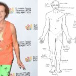 Richard Simmons' Autopsy Shows His Corpse 'Riddled With Abrasions'