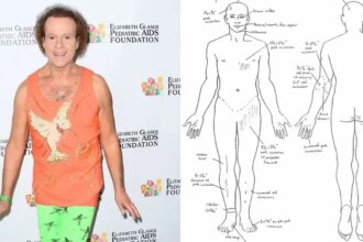 Richard Simmons' Autopsy Shows His Corpse 'Riddled With Abrasions'