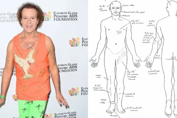 Richard Simmons’ Autopsy Shows His Corpse ‘Riddled With Abrasions’