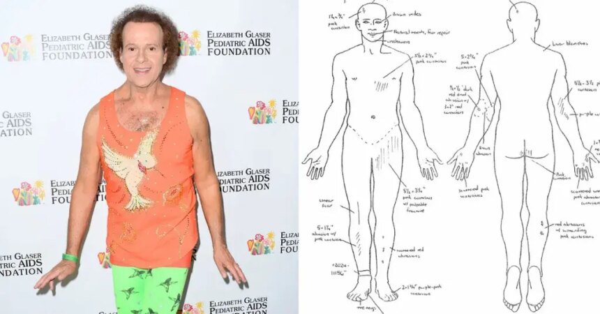 Richard Simmons' Autopsy Shows His Corpse 'Riddled With Abrasions'