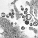 U.S. death from Lassa fever, an Ebola-like virus, is reported in Iowa 