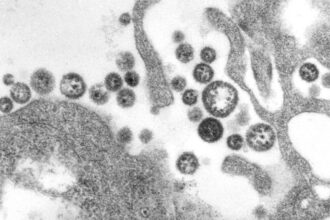 U.S. death from Lassa fever, an Ebola-like virus, is reported in Iowa 