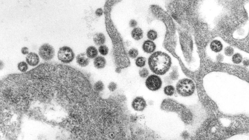 U.S. death from Lassa fever, an Ebola-like virus, is reported in Iowa 