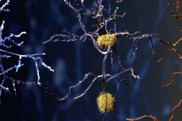 Brain Autopsies Reveal a Potential New Culprit Behind Alzheimer’s : ScienceAlert
