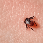 How hitchhiking ticks are bringing diseases to new places