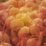 A scanning electron microscope image shows a close up of fat tissue in false color. The cells are rounded with strings of connective tissue attached.