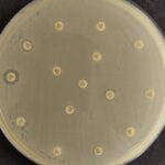 Multidrug-resistant strain of K. pneumoniae detected in Northeast Brazil