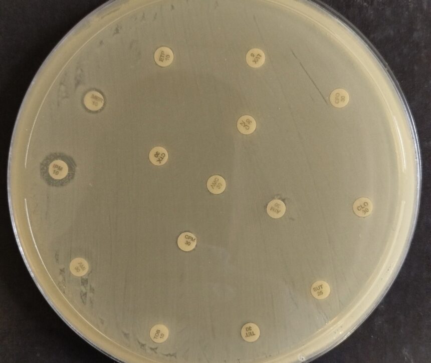 Multidrug-resistant strain of K. pneumoniae detected in Northeast Brazil