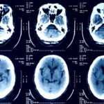 a selection of X-ray scans of a human head