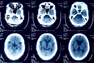 a selection of X-ray scans of a human head