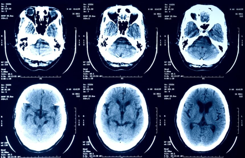 a selection of X-ray scans of a human head