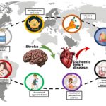 Research highlights disparities in heart disease, stroke trends worldwide