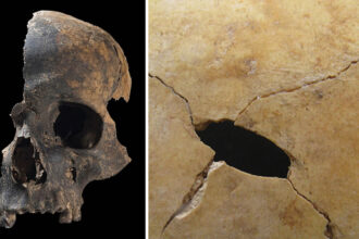 On the left, an image of the left side of a human skull, including the whole nose and mouth region, against a black background. On the right, a close-up of a sheet of bone with a puncture wound mark in it.