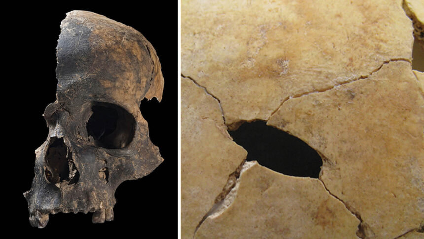 On the left, an image of the left side of a human skull, including the whole nose and mouth region, against a black background. On the right, a close-up of a sheet of bone with a puncture wound mark in it.