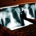 By 2040, Over 62.4 Million People In India Might Have Tuberculosis: Study