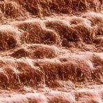 False-colour scanning electron micrograph of skin from the palm of the hand of a 30 year old man. The skin here is neatly arranged in ridges. Sweat pores are seen as miniature craters along the ridges. The cells forming the external surface of the skin, or epidermis, have been flattened & hardened by deposition within them of the fibrous protein keratin. This tough, dead layer of cells is shed continuously & is replaced by new, maturing cells which take a month to migrate from the base of the epidermis. Magnification: x20 at 6x4.5cm size