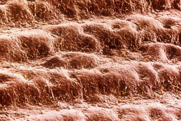 False-colour scanning electron micrograph of skin from the palm of the hand of a 30 year old man. The skin here is neatly arranged in ridges. Sweat pores are seen as miniature craters along the ridges. The cells forming the external surface of the skin, or epidermis, have been flattened & hardened by deposition within them of the fibrous protein keratin. This tough, dead layer of cells is shed continuously & is replaced by new, maturing cells which take a month to migrate from the base of the epidermis. Magnification: x20 at 6x4.5cm size