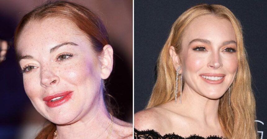 Secrets Behind Lindsay Lohan’s 0k Face Revealed As She Heads for 40
