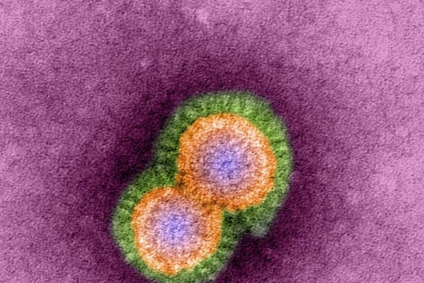 First Human Bird Flu Death in U.S. Reported—How Worried Should We Be?