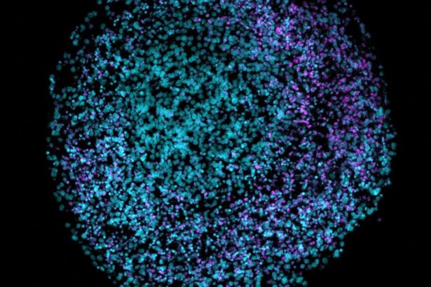 Head trauma, herpes, and Alzheimer’s, and a Q&A with Califf