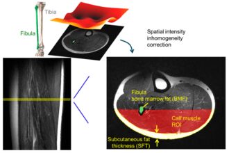 Study reveals how sex and age influence fat in muscles and bones