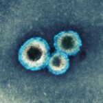 What Is Human Metapneumovirus, and Why Are Cases Rising in China?